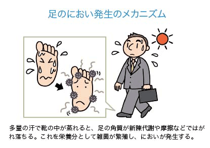 足のにおいの原因