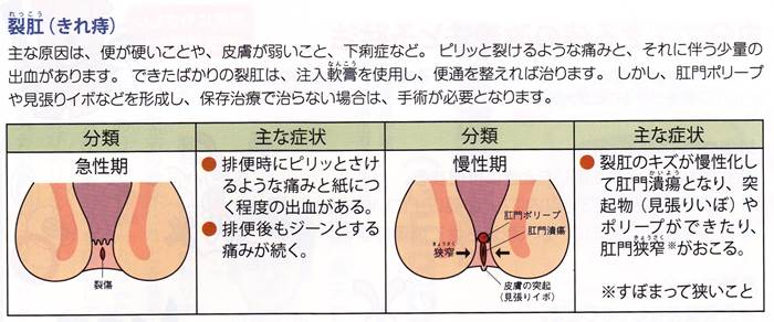 きれ痔症状